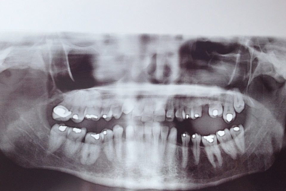 “Literal” by Josh&nbsp;Lefkowitz